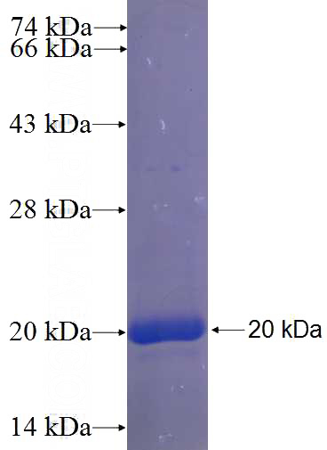 Recombinant Human ZIM2 SDS-PAGE