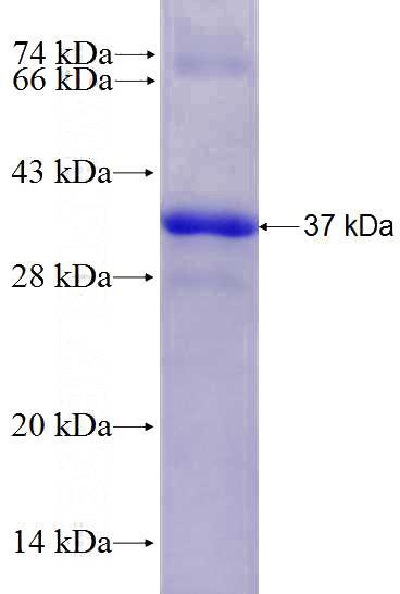 Recombinant Human CFTR SDS-PAGE