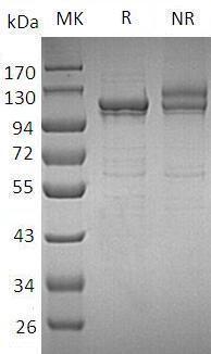 Human MANSC1/LOH12CR3/UNQ316/PRO361 (His tag) recombinant protein