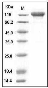 Human IL6ST / gp130 / CD130 Protein (His & Fc Tag) SDS-PAGE