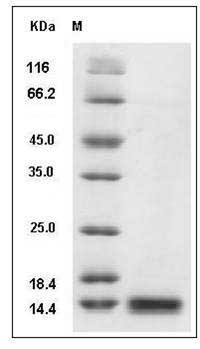 Rat B2M / Beta-2-microglobulin Protein (His Tag) SDS-PAGE