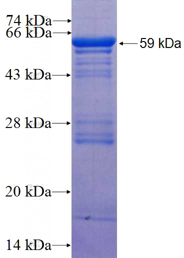 Recombinant Human CDH15 SDS-PAGE