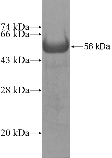 Recombinant Human PRKAR1B SDS-PAGE