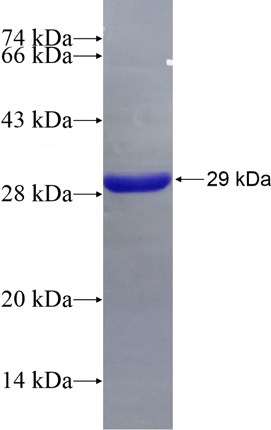 Recombinant Human ARHGDIB SDS-PAGE