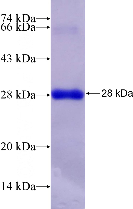 Recombinant Human SRY SDS-PAGE