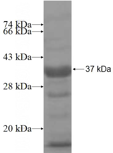 Recombinant Human TBCD SDS-PAGE