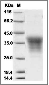 Cynomolgus EDAR Protein (His Tag) SDS-PAGE