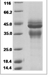Human IL12/IL12A & IL12B Protein 14757