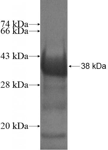Recombinant Human CD248 SDS-PAGE