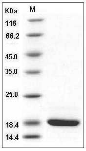 Human REG3G / PAP1B Protein (His Tag) SDS-PAGE