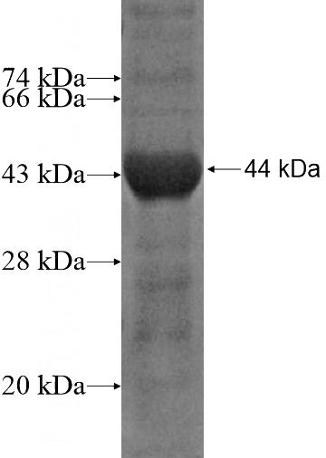 Recombinant Human MED14 SDS-PAGE