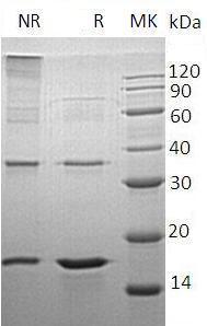 Human LSM4 (His tag) recombinant protein