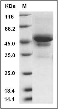 Canine Carbonic Anhydrase IX / CA9 Protein (His Tag) SDS-PAGE
