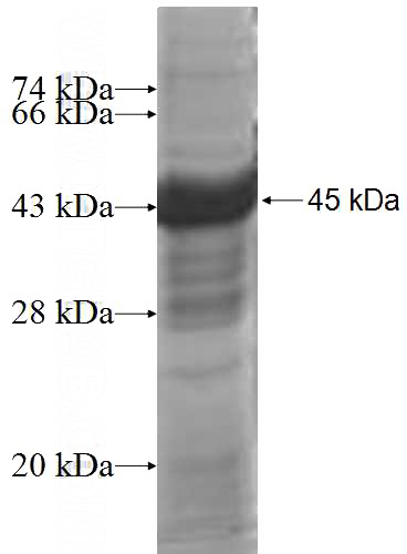 Recombinant Human IFT122 SDS-PAGE