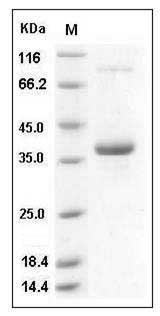 Human Epiregulin / EREG Protein (Fc Tag) SDS-PAGE