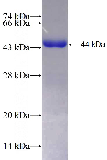 Recombinant Human GPT2 SDS-PAGE