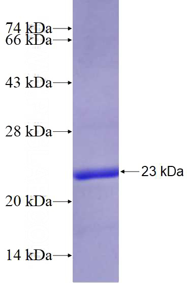 Recombinant Human DMC1 SDS-PAGE