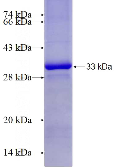 Recombinant Human CCNG1 SDS-PAGE