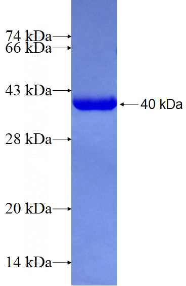 Recombinant Human POLA1 SDS-PAGE