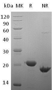 Human CLEC3B/TNA (His tag) recombinant protein