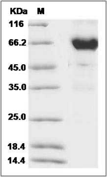 Cynomolgus IL2RA Protein (Fc Tag) SDS-PAGE