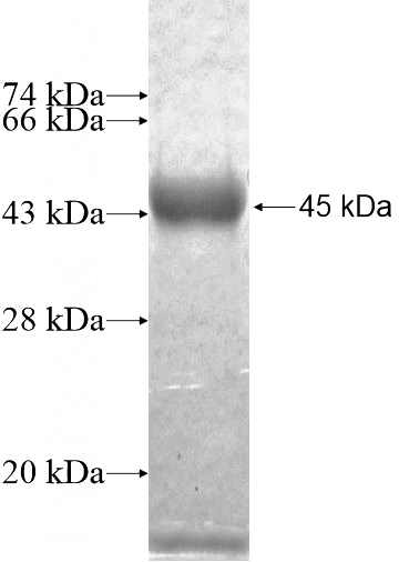 Recombinant Human PSD2 SDS-PAGE