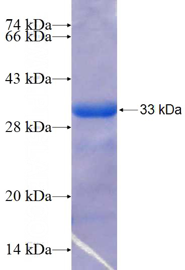 Recombinant Human MMADHC SDS-PAGE