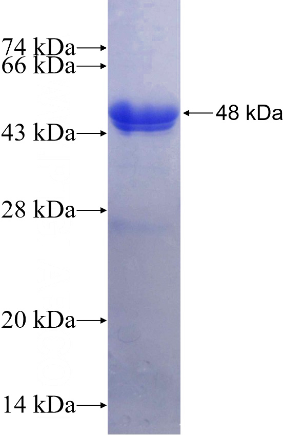 Recombinant Human NPM3 SDS-PAGE