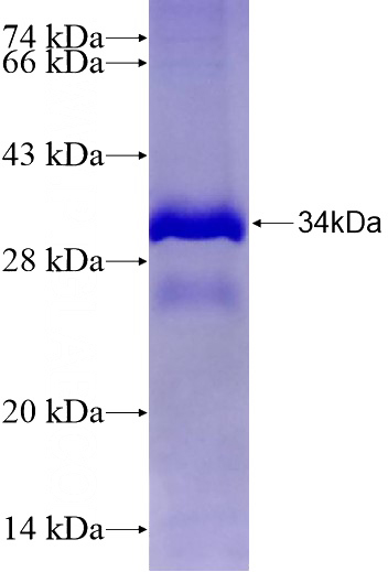 Recombinant Human ZNF559 SDS-PAGE