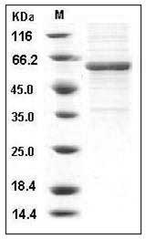Human METAP1 Protein (Fc Tag) SDS-PAGE