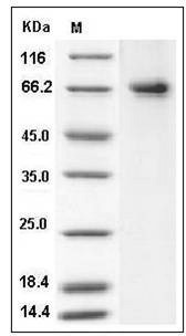 Human PTGS2 / COX2 / PGHS-2 Protein (His Tag) SDS-PAGE