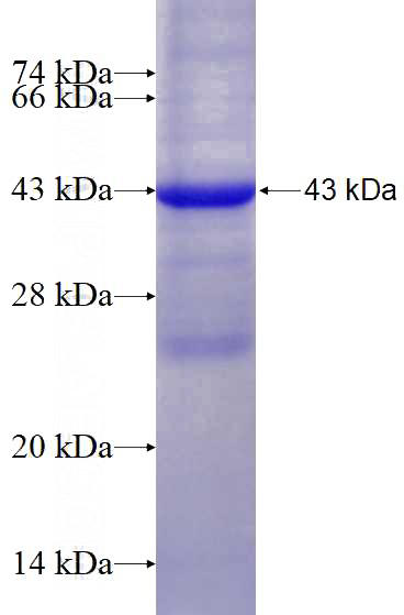Recombinant Human CYP11B1 SDS-PAGE