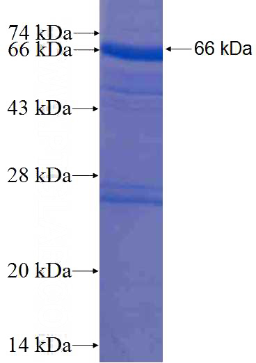 Recombinant Human HPS4 SDS-PAGE