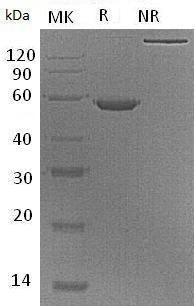 Human EFNA5/EPLG7/LERK7 (Fc tag) recombinant protein