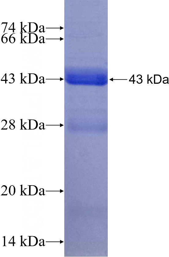 Recombinant Human NDUFAB1 SDS-PAGE
