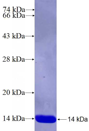 Recombinant Human CACNA2D1 SDS-PAGE