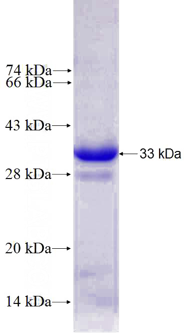 Recombinant Human C22orf25 SDS-PAGE