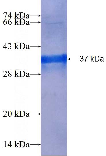 Recombinant Human DNMT3B SDS-PAGE