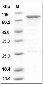 Human OXSR1 / OSR1 Protein (GST Tag) SDS-PAGE