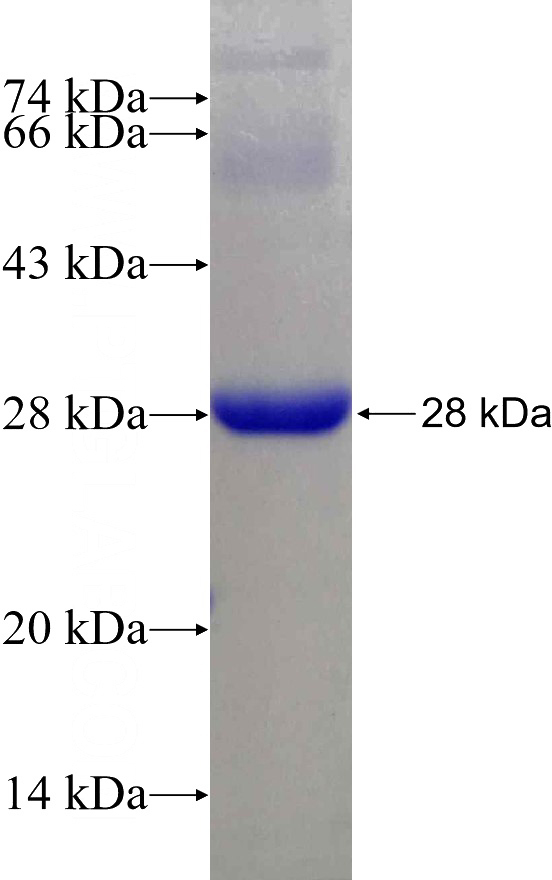 Recombinant Human MIS12 SDS-PAGE