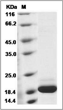 Mouse IFNA14 / Interferon alpha-14 Protein (His Tag) SDS-PAGE