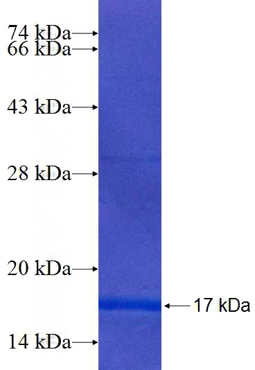 Recombinant Human DYNLRB1 SDS-PAGE