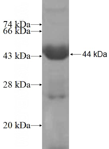 Recombinant Human RNPEP SDS-PAGE