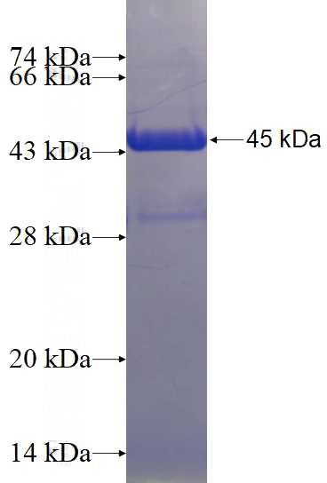 Recombinant Human NAV1 SDS-PAGE