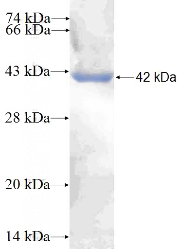 Recombinant Human SFRP5 SDS-PAGE