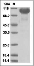Human NLGN4X Protein (His Tag) SDS-PAGE