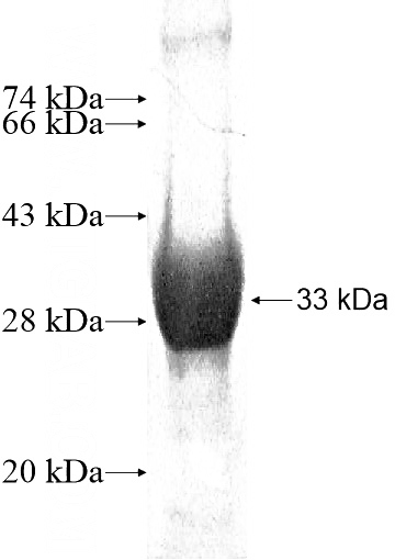 Recombinant Human GNPDA2 SDS-PAGE