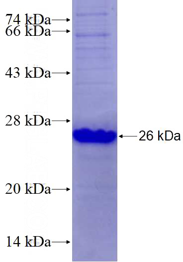 Recombinant Human PPARD SDS-PAGE