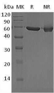 Human PFKFB1/F6PK/PFRX (His tag) recombinant protein