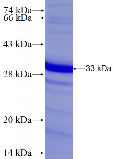 Recombinant Human GGA2 SDS-PAGE